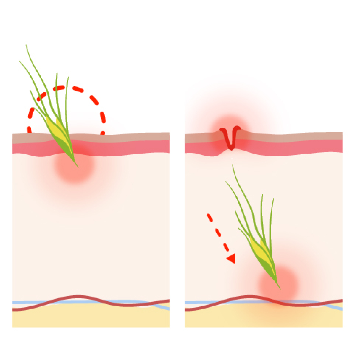 das Risiko für die Haut eines Hundes